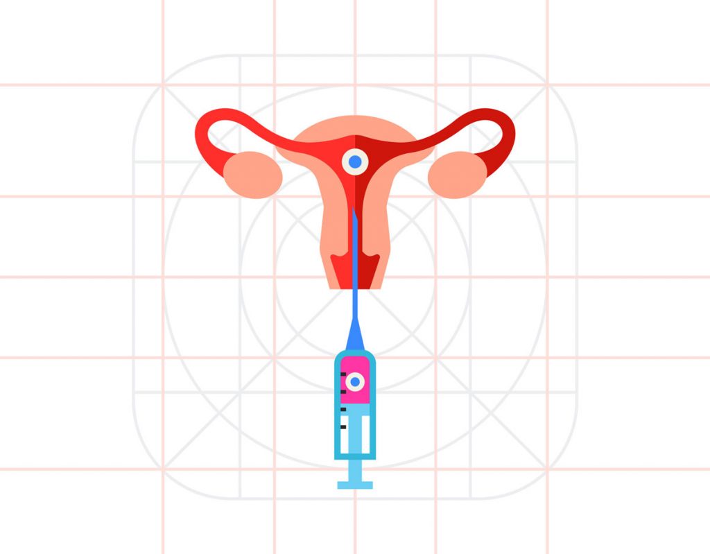 החזרת עוברים מוקפאים - פרופ'.מ. עינת שלום פז, רופאת פוריות, אבחון וייעוץ להפרעות פוריות, טיפולי פריון וטיפולי IVF